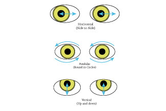 nystagmus illustration thumbnail.jpg